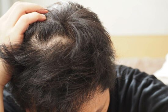 tips for stronger and healthier hair man
